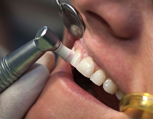 Síntomas de la enfermedad periodontal