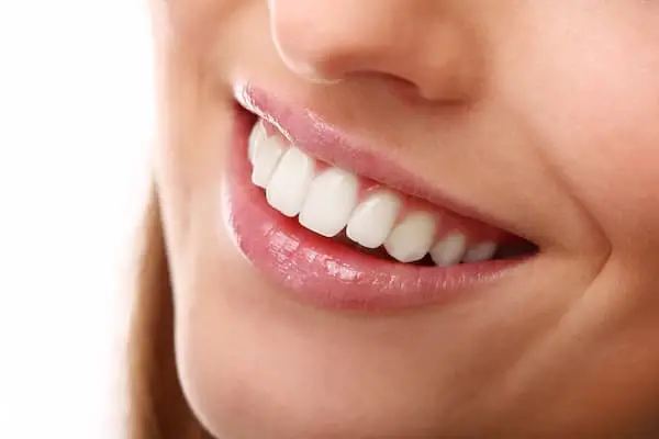 estetica-dental-madrid-sonrisa-1